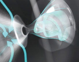 トルネードミスト